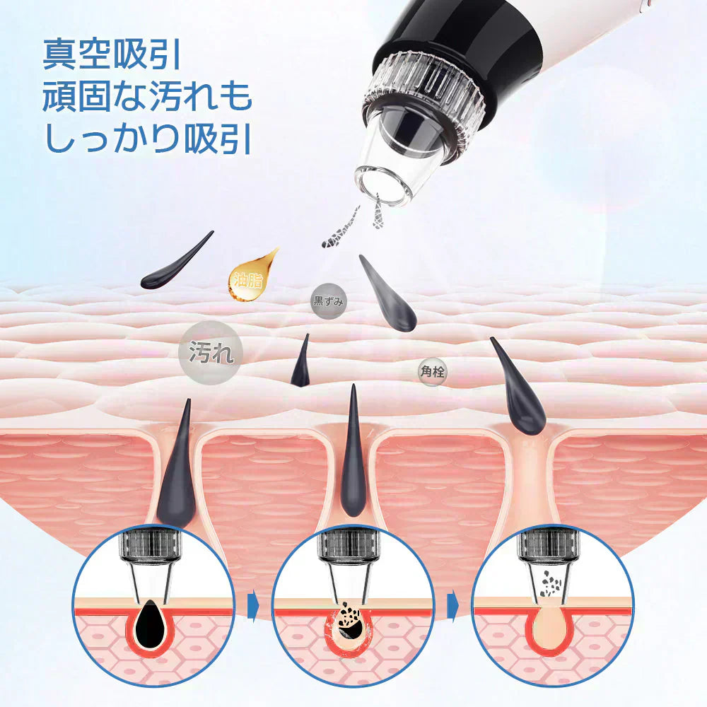 毛穴吸引器 サーリシ 光エステ 毛穴吸引 毛穴吸引機 毛穴ケア 毛穴 吸引 角質ケア 黒ずみ 鼻 角栓 コンパクト毛穴クリーン 5種類吸引ヘッド 美肌 Sarlisi ABF090