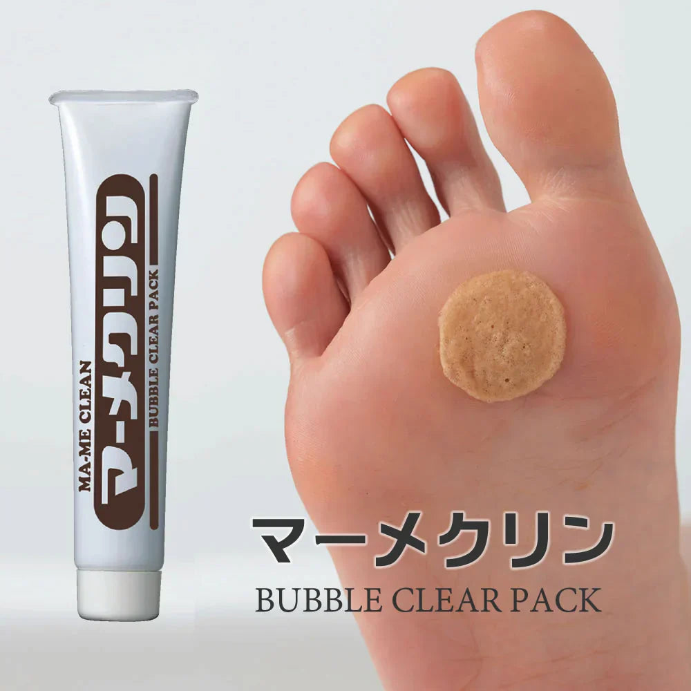 【マーメクリン】歩くとつらいガチガチ底マメ対策専用パック 朝起きたらべローンとはがすだけ 底まめ 固いまめ 泡パック 塗って剥がすだけ 美容成分配合 12種類の植物エキス 寝ながらケア ナイトケア 簡単ケア 角質除去 まめ剥がしケア フットケア用品 フットケア 爪 爪ケア ガチガチ底マメ マメケア つらーい底マメ 底マメ ケア コラーゲン 簡単ケア 日本製 足ケア あしケア