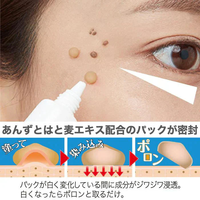 【プツとろりんパック】日本製 国産 あんず はと麦 目尻 首 黒凸粒 密封集中パック 植物エキス 美肌成分 角質ケア 角質除去 顔 スキンケア パック ポツポツ はと麦エキス 乳酸桿菌 あんずエキス 日本製 国産 おすすめ 人気 ランキング 効果 強力 最強 通販 美容成分 目元 目の周り 首元 ポツポツ パック 集中ケア 対策 イボ除去 角質ケア 角栓粒