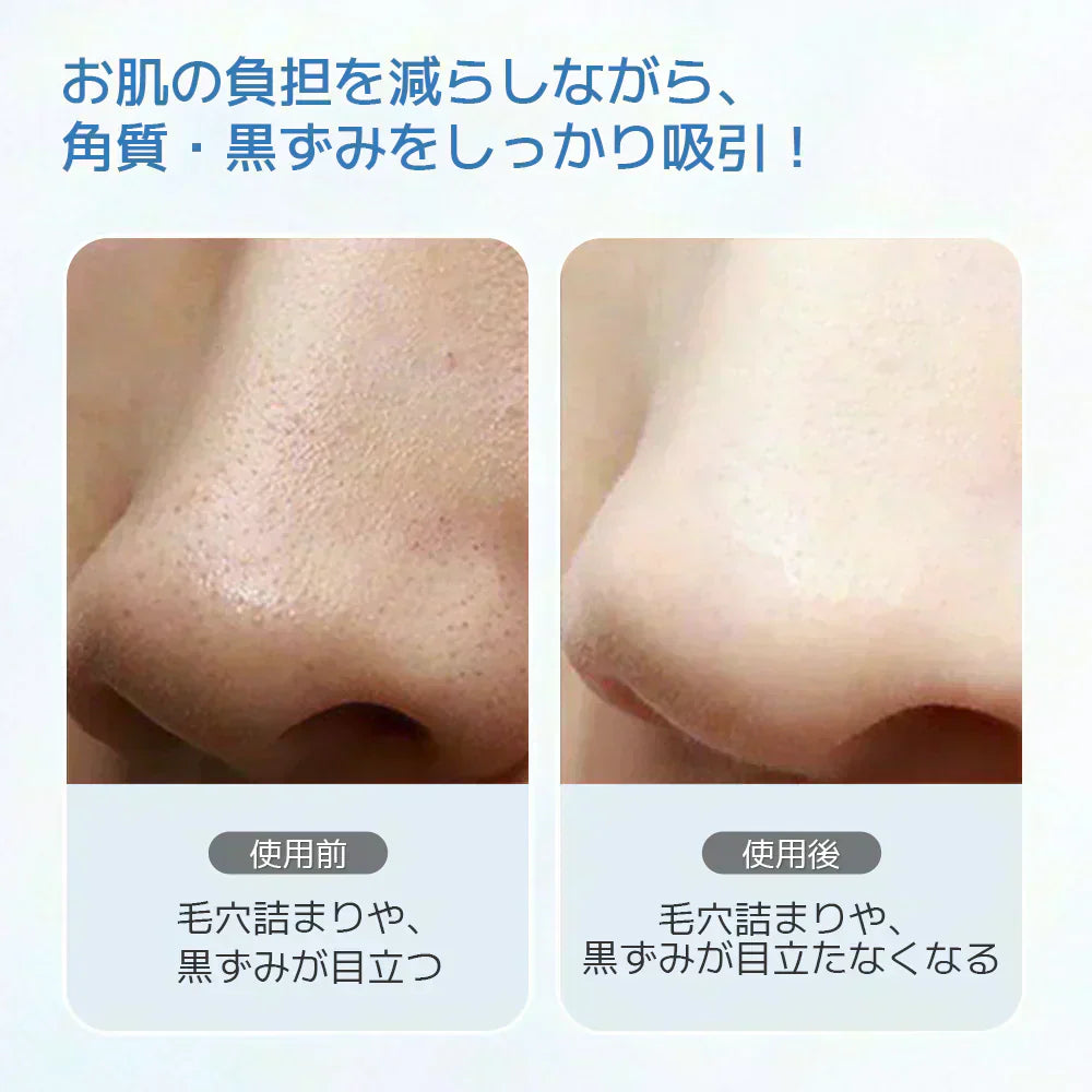 毛穴吸引器 サーリシ 光エステ 毛穴吸引 毛穴吸引機 毛穴ケア 毛穴 吸引 角質ケア 黒ずみ 鼻 角栓 コンパクト毛穴クリーン 5種類吸引ヘッド 美肌 Sarlisi ABF090