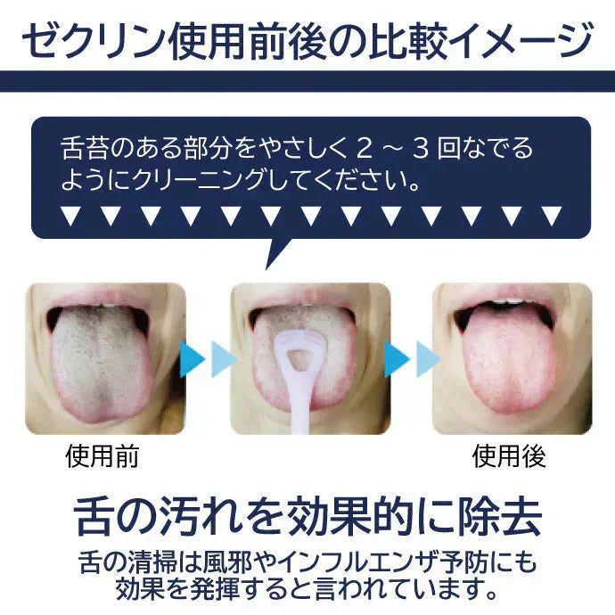 舌ブラシ ゼクリン (ソフトタイプ) 1本(袋入)【メール便送料無料】 / 舌クリーナー タンクリーナー 口臭予防