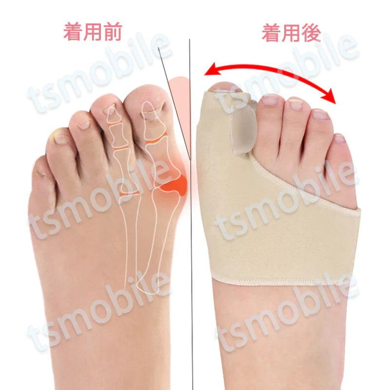 外反母趾サポーター Lサイズ 靴下 ライクラ繊維生地 足指 つま先 親指保護 矯正 ソルボ やわらか 男女兼用 外反母趾グッズ フットケア 左右 靴下 弾力 痛み軽減 矯正