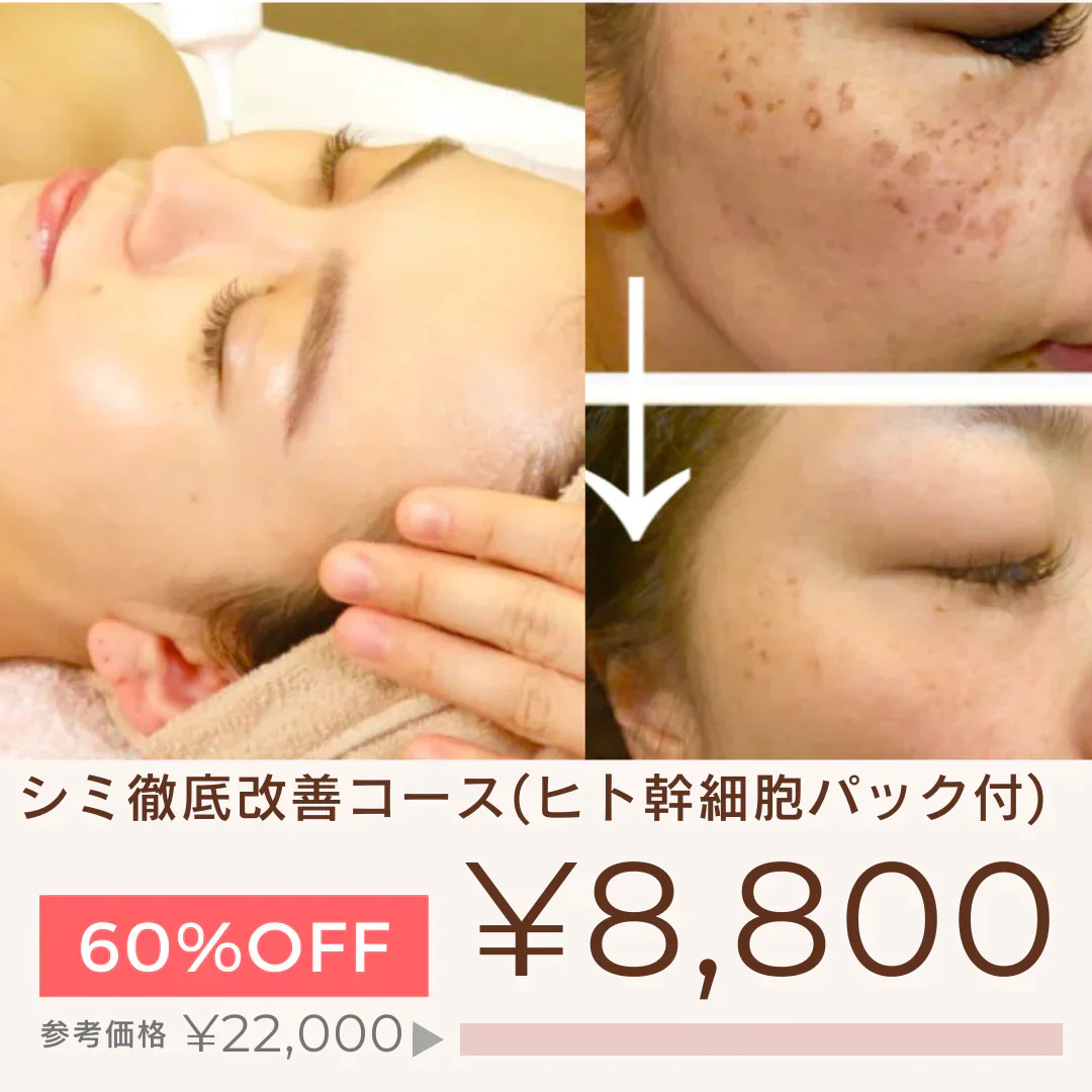 新規限定】シミ徹底改善コース(ヒト幹細胞パック付) 【美容サロン