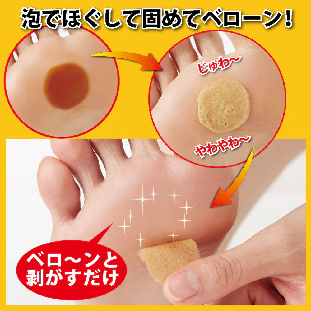 【マーメクリン】歩くとつらいガチガチ底マメ対策専用パック 朝起きたらべローンとはがすだけ 底まめ 固いまめ 泡パック 塗って剥がすだけ 美容成分配合 12種類の植物エキス 寝ながらケア ナイトケア 簡単ケア 角質除去 まめ剥がしケア フットケア用品 フットケア 爪 爪ケア ガチガチ底マメ マメケア つらーい底マメ 底マメ ケア コラーゲン 簡単ケア 日本製 足ケア あしケア