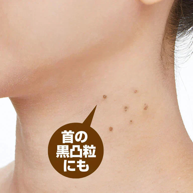 【プツとろりんパック】日本製 国産 あんず はと麦 目尻 首 黒凸粒 密封集中パック 植物エキス 美肌成分 角質ケア 角質除去 顔 スキンケア パック ポツポツ はと麦エキス 乳酸桿菌 あんずエキス 日本製 国産 おすすめ 人気 ランキング 効果 強力 最強 通販 美容成分 目元 目の周り 首元 ポツポツ パック 集中ケア 対策 イボ除去 角質ケア 角栓粒