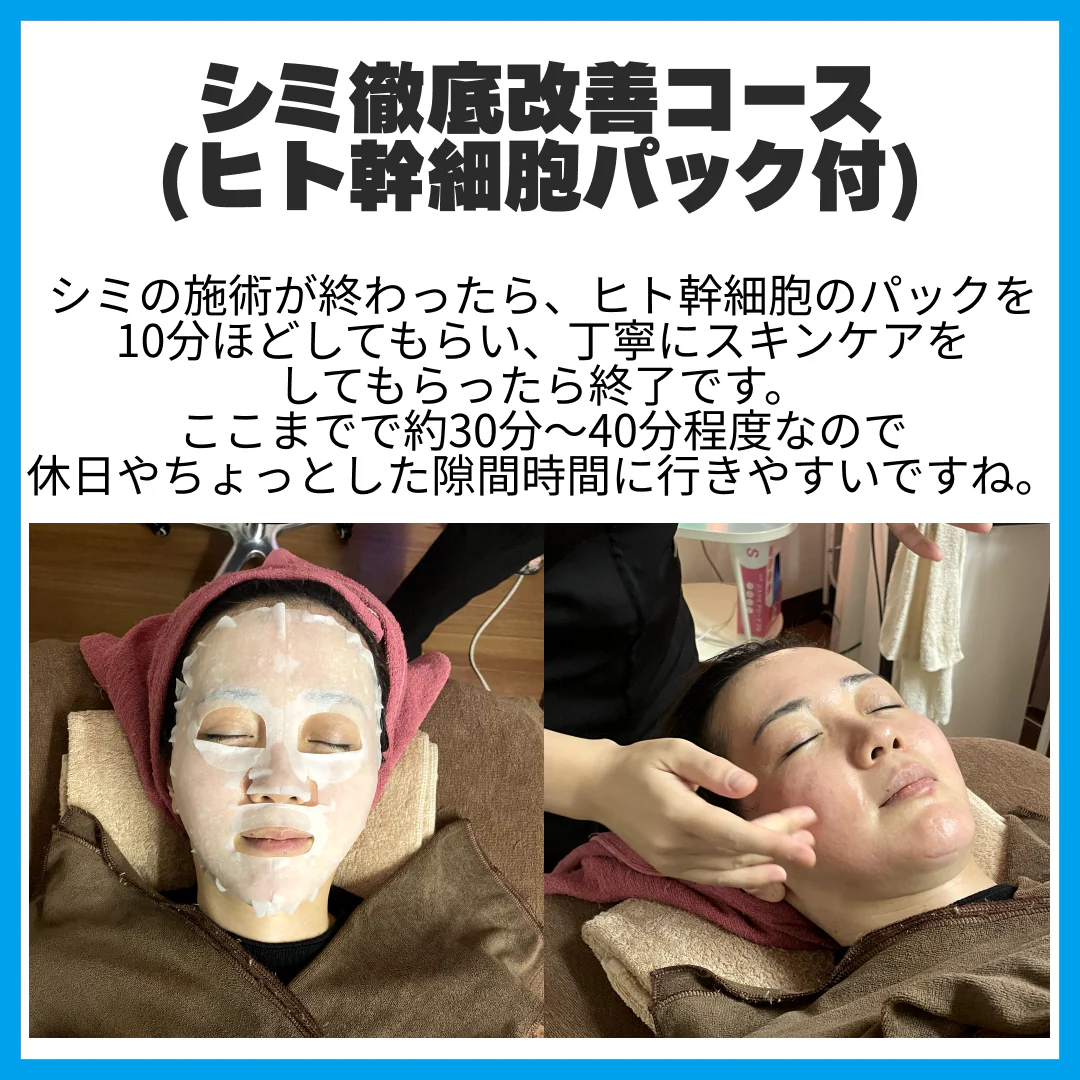 【新規限定】シミ徹底改善コース(ヒト幹細胞パック付) 【美容サロンチケット】美容/エステ/フェイシャルエステ/東京/新宿/メディカライクサロンSOU新宿