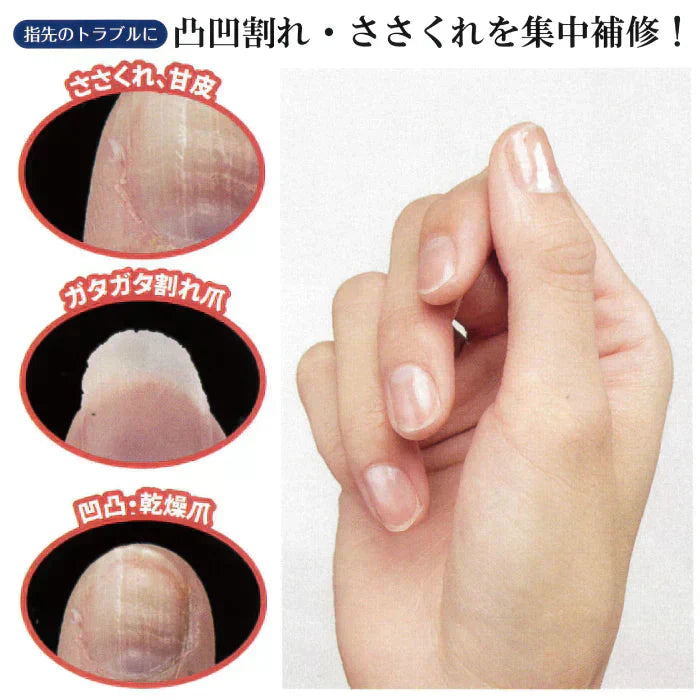 【甘皮ハニー】 凸凹割れ爪 痛いささくれをふわふわクリームで集中補修 ハンドケア 乾燥する指先 爪を集中保湿してくれる クリーム ネイルケアグッズ 甘皮 乾燥爪 割れ爪 ケラチン 尿素 ハチミツ ネイルケアグッズ 甘皮 乾燥爪 割れ爪 凹凸爪 ささくれ ハンドケア クリーム 乾燥 指先 爪 保湿 保湿クリーム