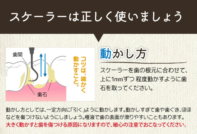 両頭鎌型スケーラー H5-33 1本【歯石取り 歯垢取り ヤニ取り】【ご新規さん限定商品】【メール便送料無料】