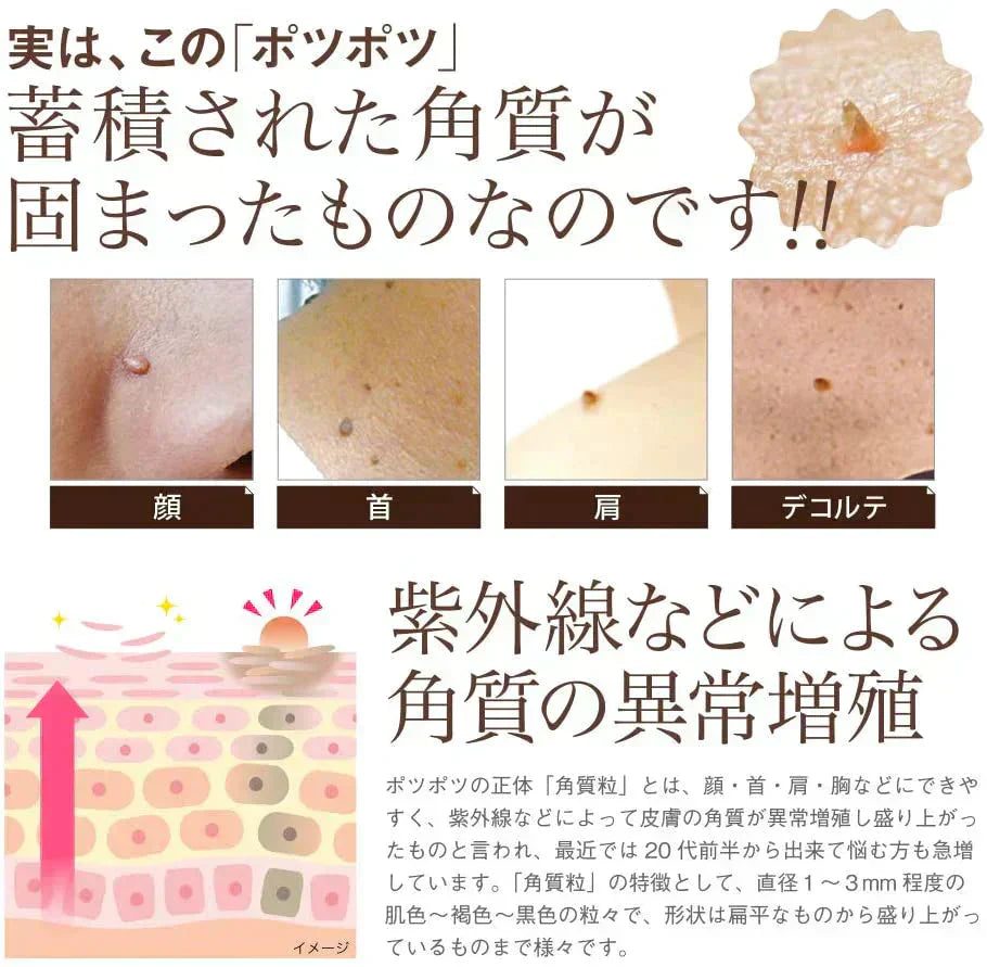 【イポケアEX】首元やフェイスラインのポツポツを集中ケア! 美容液 角質 ケア スキンケア 顔 首筋 胸元 イボ ポツポツ バチルス発酵液 ヨクイニンエキス ウワウルシ葉エキス イポケア 送料無料 ポツポツ専用 美容液 いぼ取り 除去 お肌のポツポツ 角質 ケアバチルス発酵液 18ml 角質粒 顔 首 肩 胸 美容 ケア お肌 ボディケア ぶつぶつ 日本製 イボの悩み おすすめ 人気 ランキング 効果 強力 最強 角質ケア