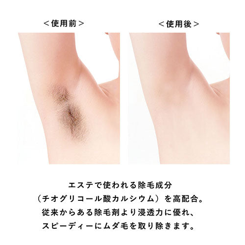 医薬部外品 エピプレミアムクリームDX