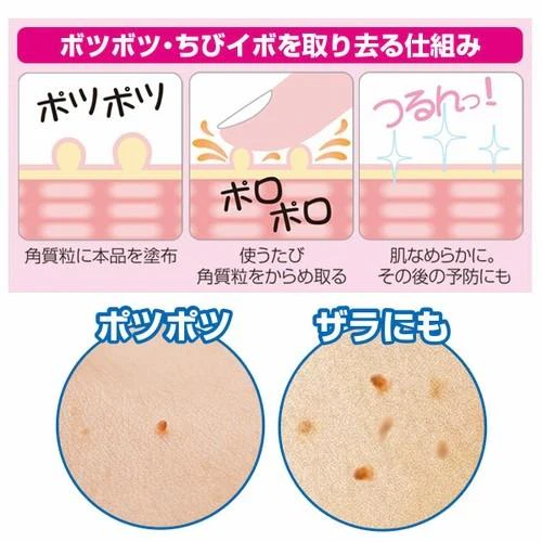 薬用ピーリングスムーサーEX ざらつきケア 25g