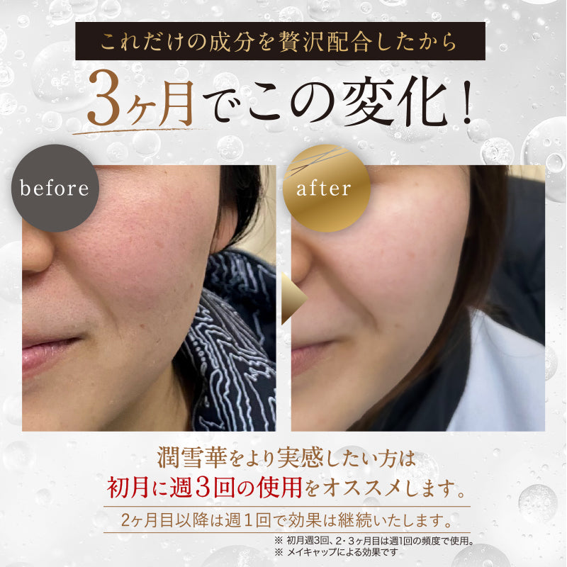 【塗って固まる】洗い流さない炭酸パック 潤雪華
