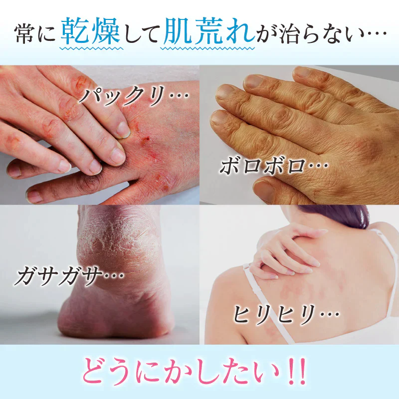 TEINEIはじめてセット ハンドエッセンス&ボディローション スキンケア コスメ ハンドクリーム ボディクリーム 美容液 乾燥 保湿 敏感肌