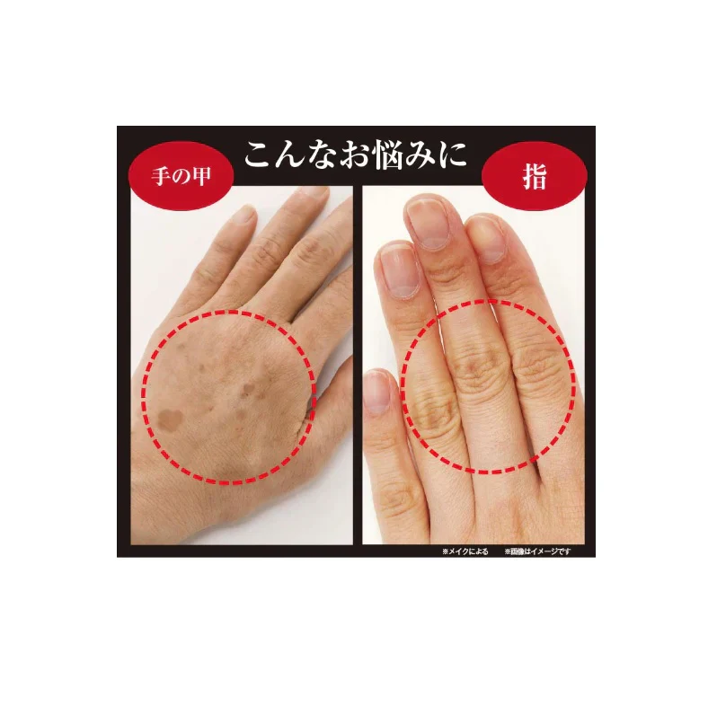 薬用 MISETE【シミ シワ 紫外線カット ハンドケア ハンドクリーム 薬用クリーム 手のファンデーション 手の甲 コンシーラー シミ 対策 肌質 美容 白い肌 メラニン しみ しわ 紫外線 uv メラニン生成を抑え シミ そばかす ガサガサ 乾燥肌 日本製  医薬部外品 美白 紫外線カット ハンドケア ハンドクリーム 薬用美白クリーム 手のファンデーション 手の甲 ミセテ 薬用ミセテ