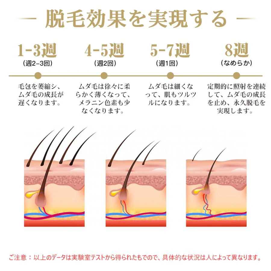 脱毛器 無痛脱毛 IPL脱毛器 光美容器 ヒゲ ムダ毛処理 全身脱毛 5段階照射レベル コラーゲン活性化 美肌効果 99万発照射 ビキニライン脱毛 夏