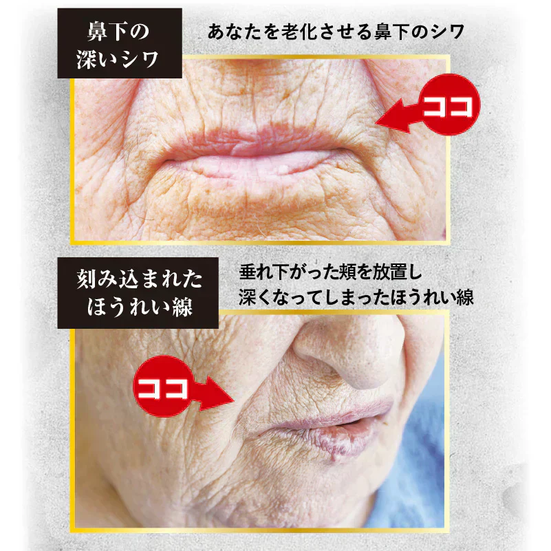 【クイックヤング プレミアム】口元の老けジワをピーン！卵殼膜美容液 化粧品 美容液 口元 小じわ 老けジワ 縦ジワ 昼夜兼用 メイク前 就寝前 卵殻膜エキス 保湿 乾燥対策 メイク下地 美容クリーム アミノ酸 コラーゲン ヒアルロン酸 ハリ ツヤ 気になる老けジワ シワ改善 しわ改善 クリーム 首 シワ改善クリーム しわ改善 しわ取り シワとり しわとり しわ取り