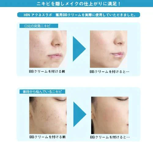 HINアクネスラボ薬用BBクリーム(ライトベージュ)【医薬部外品】35g