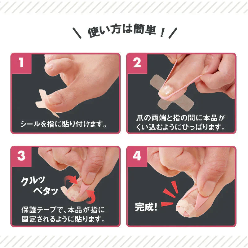 【やわらか巻き爪ガード】辛い巻き爪をしっかりサポート 巻き爪でお悩みの方におすすめ 歩くのが痛くてお出かけがツライ 爪切りが痛くてツライ  爪が痛くてお気に入りの靴が履けない巻き爪 クッション シリコン 保護テープ 深爪 浮き爪 外反母趾 矯正 親指 保護パット 痛み軽減 繰り返し使える 左右兼用 日本製  	 形状記憶特殊3Dシリコーンの反発力で巻き爪を引き上げ