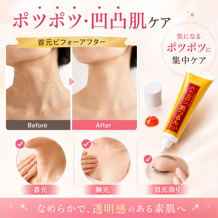 トミーリッチ ハトムロン肌つるん [ ハトムギ 美容液 イボ いぼ ポツポツ 保湿 なめらか なめらかな肌 角質粒 凹凸肌 イボ サメ肌 美肌 つるつる 国産 スキンケア 角質除去 イボ取り 日本製 送料無料 ]