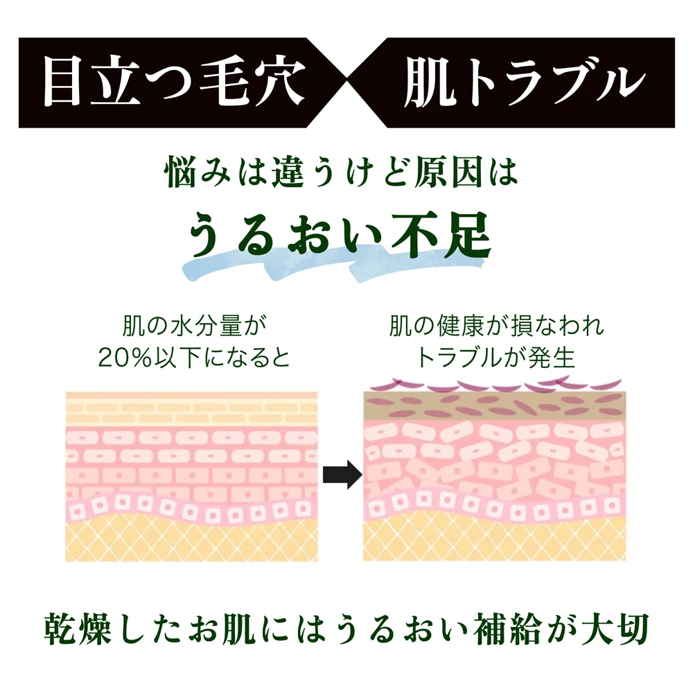 5種のヒアルロン酸配合スキンローション 600ml◆ 化粧水 おすすめ 潤い 美白 大容量 お徳用 スキンケア メンズ 男女兼用 無添加 無香料 乾燥肌 敏感肌 保湿