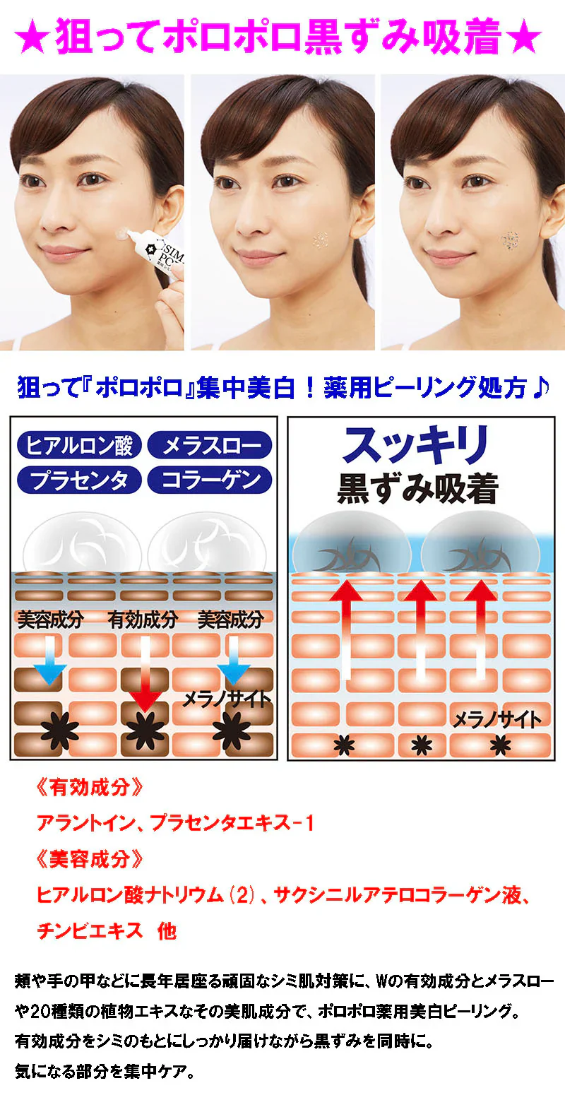 薬用シミーポロン【シミケア くすみ 黒ずみ 薬用ピーリング 吸着 シミ対策 肌荒れ対策 薬用美白パック 塗って１分】シミケア くすみ 黒ずみ 薬用ピーリングシミ対策 肌荒れ対策 パック塗って１分 シミケア くすみ 黒ずみ 薬用ピーリング 吸着 シミ対策 肌荒れ対策 薬用パック 薬用ピーリン　シミケア　くすみ　黒ずみ　気になる角質層の黒ずみ くすみが 消しゴムみたいにポロポロ 薬用ピーリングパックプラセンタ アラントイン 有効成分 ヒアルロン酸 コラーゲン