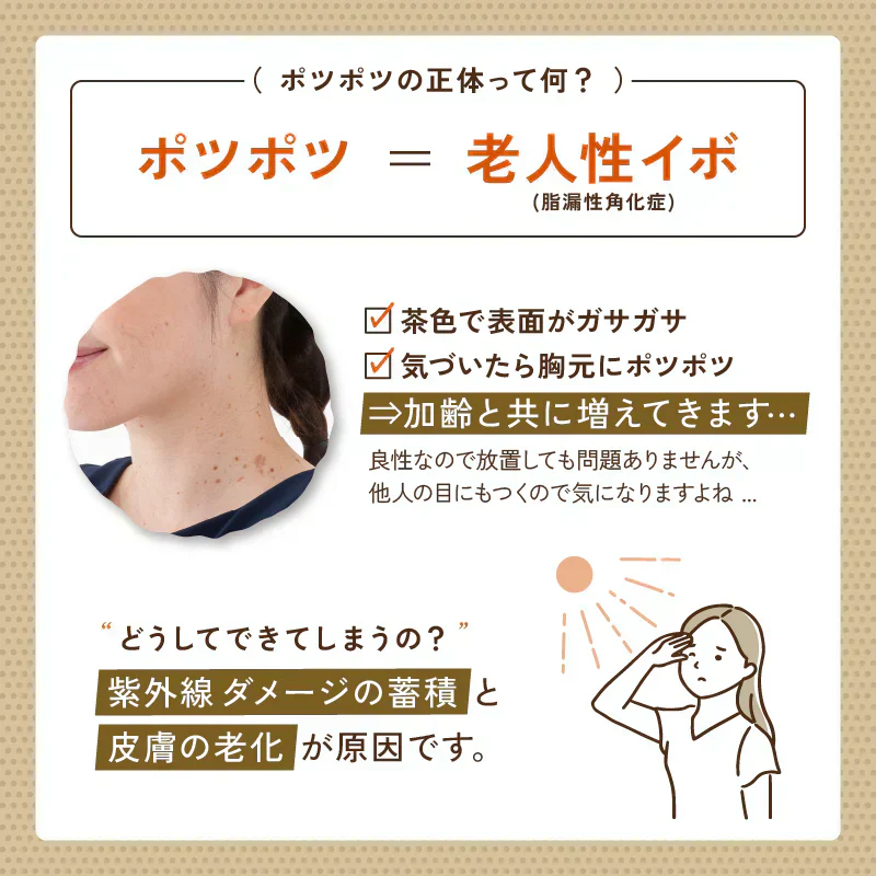 【薬用イポツルン】首元や目元の気になるポツポツに特化した 美容液 習慣 老人性イボ 角質粒 シミ はとむぎ 杏仁 肌荒れ クリーム 胸元 デコルテ ぽつぽつ ブツブツ 目・首まわり 年齢を重ねた肌の悩み 薬用 日本製 杏仁エキス ハトムギエキス 豆乳発酵エキス 首元 目元 首いぼ 首のイボ イボ取り 角質ケア 角質粒 医薬部外品 プラセンタ グリチルリチン酸 つぶのんジェル 肌あれ あれ性 あせも しもやけ ひび あかぎれ