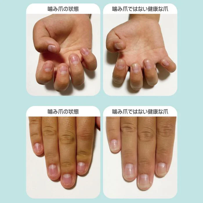 大人ネイルビターコート 7ml