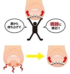 【送料無料】NEWまきづめリフト　爪やすり付き　巻きづめ　巻き爪矯正