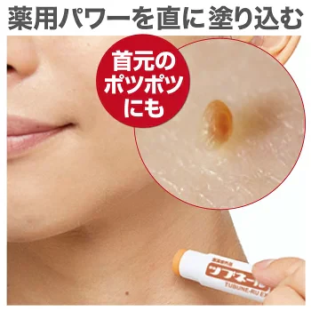 【薬用ツブネールEX】はと麦とあんずを薬用スティックに凝縮 天草エキス スティッククリーム 医薬部外品 目元・首元のぽつぽつケアにお図を薬用スティックに凝縮 天草エキス スティッククリーム 医薬部外品 ぽつぽつケアメラニン しみ そばかす あせも しもやけ ひび あかぎれ にきびを防ぐ ピーリング ゴマージュ
