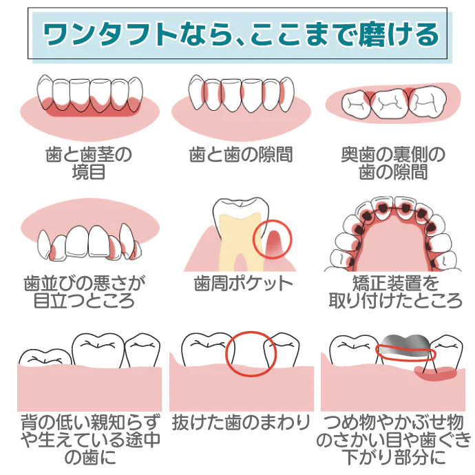 Ci PRO ワンタフトブラシ ラージヘッド Sやわらかめ 10本セット【メール便送料無料】