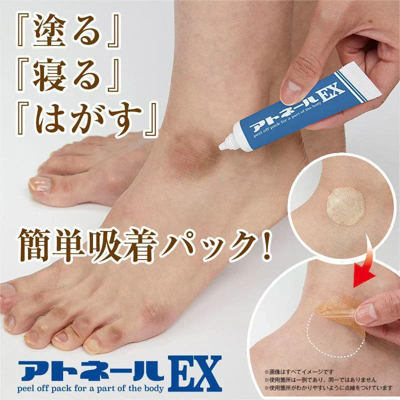 【アトネールEX 15g】 気になるところに『塗る』『寝る』『はがす』の簡単吸着パック 足の角質ケア クリーム パック 足 黒ずみ 角質 硬化 黒ずみケア 角質 ケアクリーム かかと 摩擦跡 角質硬化 黒ずみ対策 乾燥や摩擦で気になるパーツに塗って寝るだけ 古い角質をキャッチ 足の色素沈着ケア 角質硬化 吸着パック 黒ずみ フット きれい足  足ケア あしケア  角質ケア フットクリーム ボディケア フットケア デオドラント フットデオドラント