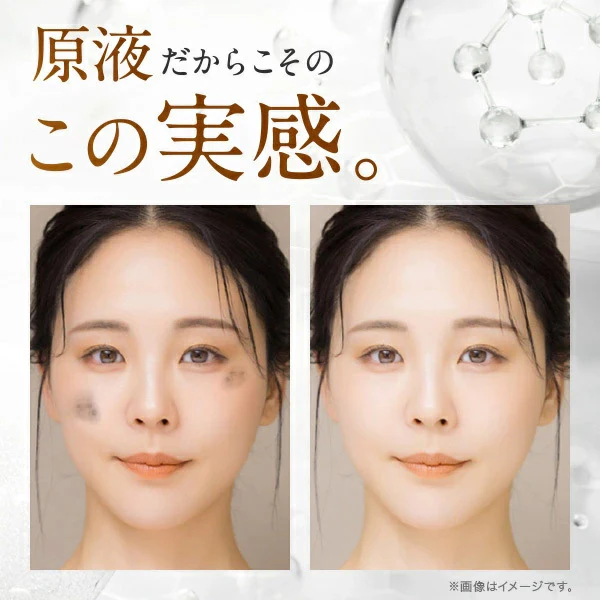 しみ 薬用美白原液エビスビーホワイト10ml トラネキサム酸 グリチルリチン酸ジカリウム 肌荒れ ニキビ メB