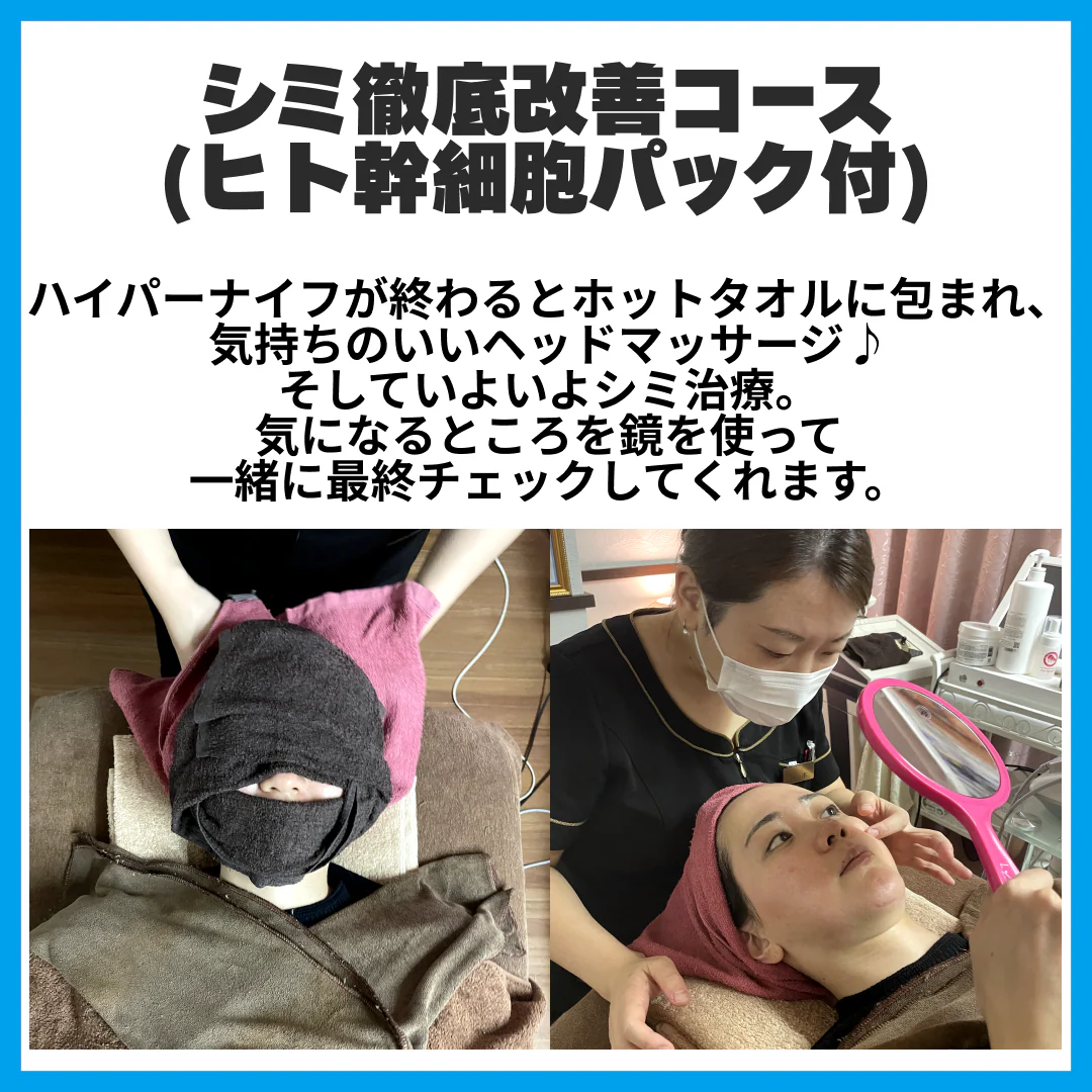 【新規限定】シミ徹底改善コース(ヒト幹細胞パック付)　【美容サロンチケット】美容/エステ/フェイシャルエステ/東京/新宿/メディカライクサロンSOU新宿