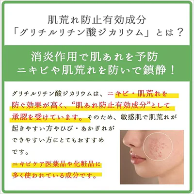 【訳あり】Care/ki Natural(ケアキナチュラル) モイスチャライジングローション×3個【医薬部外品】