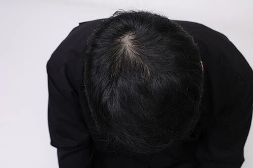 薬用育毛エッセンス ターゲットグロウ 100ml  エッセンス 育毛剤 男性用 育毛ローション 育毛 育毛促進トニック 薄毛 抜け毛 対策  薬用