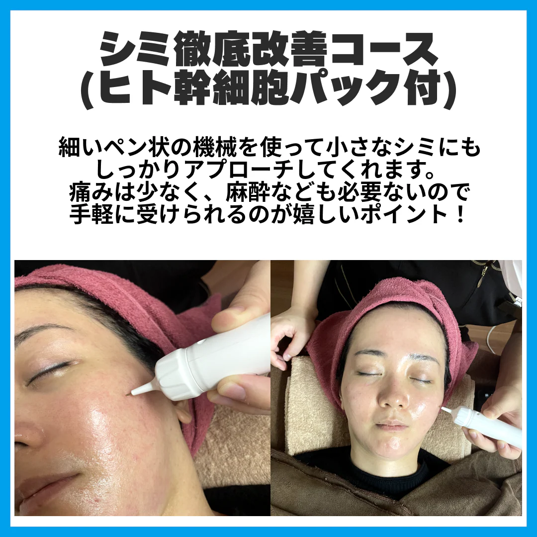 新規限定】シミ徹底改善コース(ヒト幹細胞パック付) 【美容サロン