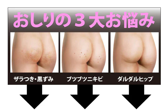 【魅惑のおしり ノーマル50g】お尻の黒ずみ ニキビ ザラザラに 美容成分＆ピーリングで美尻ケア 美尻 黒ずみ ポツポツ たるみ 医薬外部薬品 フィトスフィンゴシン ラクトフェリン リピジュア 気になるブツブツ・黒ずみ・たるみのケアはもちろん、お肌を 健やかに保ちます ピンポイントケア ヒップケア  ニキビや乾燥によるくすみ 角質汚れによるザラザラを手を汚さずにケアお尻 ニキビ予防 くすみ ザラザラ 美白 保湿 薬用有効成分