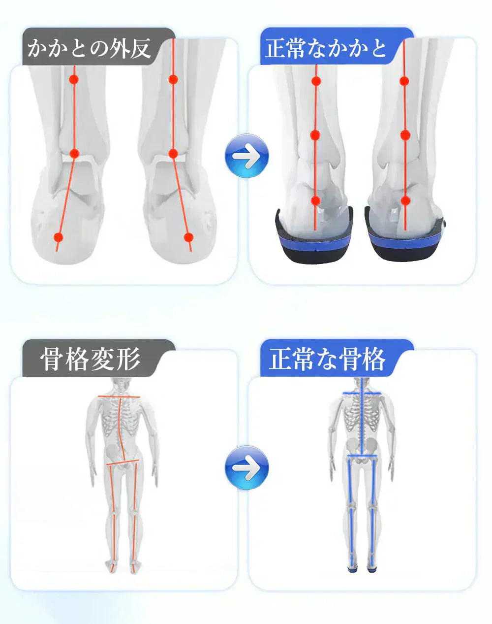 【快適な歩行を実現！】＼ XSサイズ ／高品質 インソール 衝撃吸収 衝撃 インソール 扁平足 外反母趾 足底筋膜炎 インソール 通気性 抗菌 防臭 負担対策 サポート機能 疲れない 軽量 履き心地 疲れにくい ゴルフ 靴 グッズ 中敷 メンズ レディース 蒸れ防止 抗菌防臭 特殊4層槽造 インソール