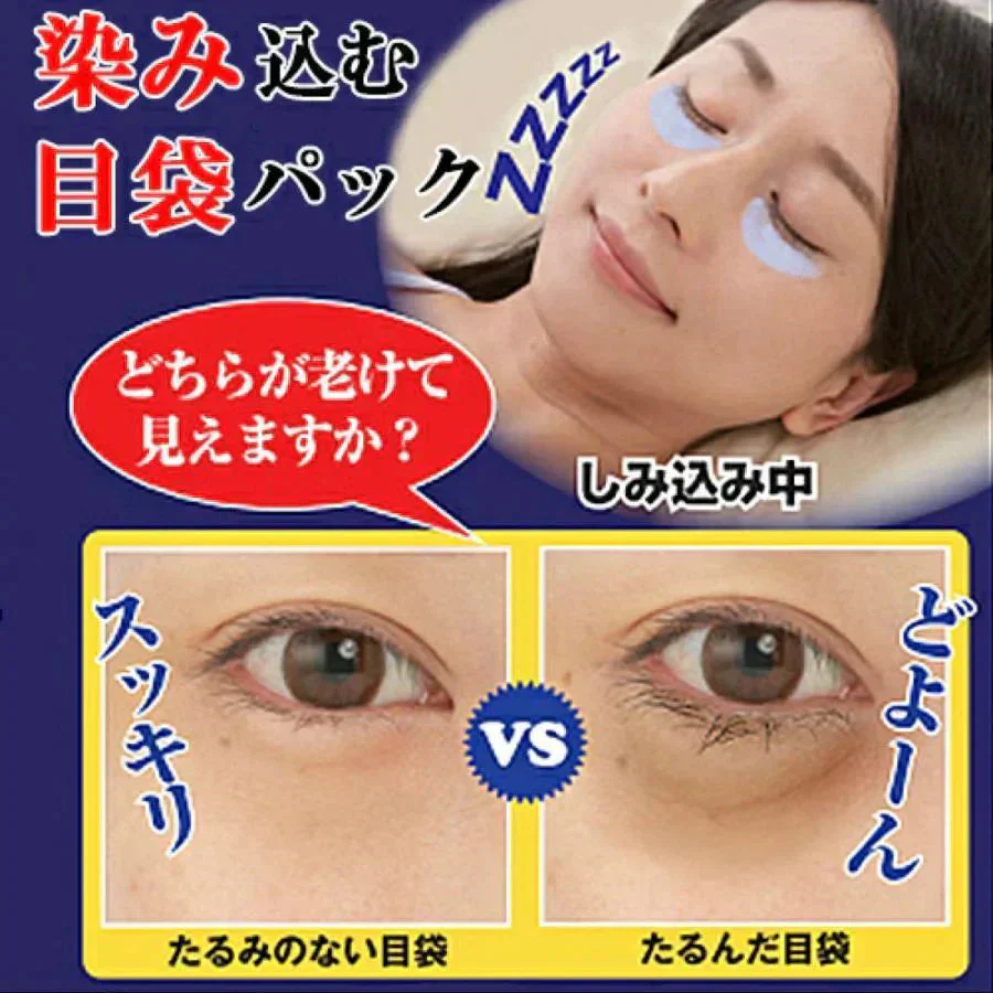 【メブネールEX 30g】 目袋 集中 ケア 目の下 アイクリーム まぶた 目元 クリーム 男性 女性 瞼 アイケア コラーゲン ビタミン 口コミ 化粧品 寝ながら 目袋ケア たるみ 黒ずみ解消 対策 予防 対策 若見え 老け顔 簡単ケア 目元のくすみやクマ 目元のお悩み コラーゲン ビタミン ナイトケア　ケアクリーム たるみ 黒ずみ 目袋パック シワ 小じわ 老け顔 黒ずみ シワ改善  ほうれい線 目尻 ハリ メラニン シワ改善成分