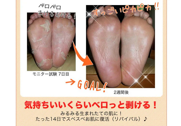リバイバルケア 足裏角質除去 ジェル 足裏美人 フットパック