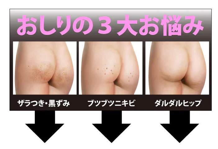 【魅惑のおしり プレミアム 薬用ジェル 大容量100g】【ピーリング ピーリングジェル お尻 ヒップケア お手入れ ニキビ 医薬部外品】気になるおしりをピンポイントケア ヒップケア ニキビや乾燥によるくすみ 角質汚れによるザラザラを手を汚さずにケア ピンポイントケア ヒップケア  ニキビや乾燥によるくすみ 角質汚れによるザラザラを手を汚さずにケアお尻 ニキビ予防 くすみ ザラザラ 美白 保湿 薬用有効成分