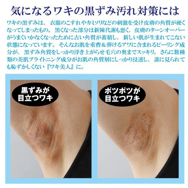 ぷっくぷく重曹　ワキ泡　プレミアムパック 【重曹　炭酸　ワキ専用　頑固な黒ずみ　汚れ　ポツポツ　角質ケア　ターンオーバー】【塗るだけ　洗い流す　簡単　90秒】【シャボンの香り】　簡単3ステップでワキの黒ずみ対策! 重曹バブルのワキ用泡パック