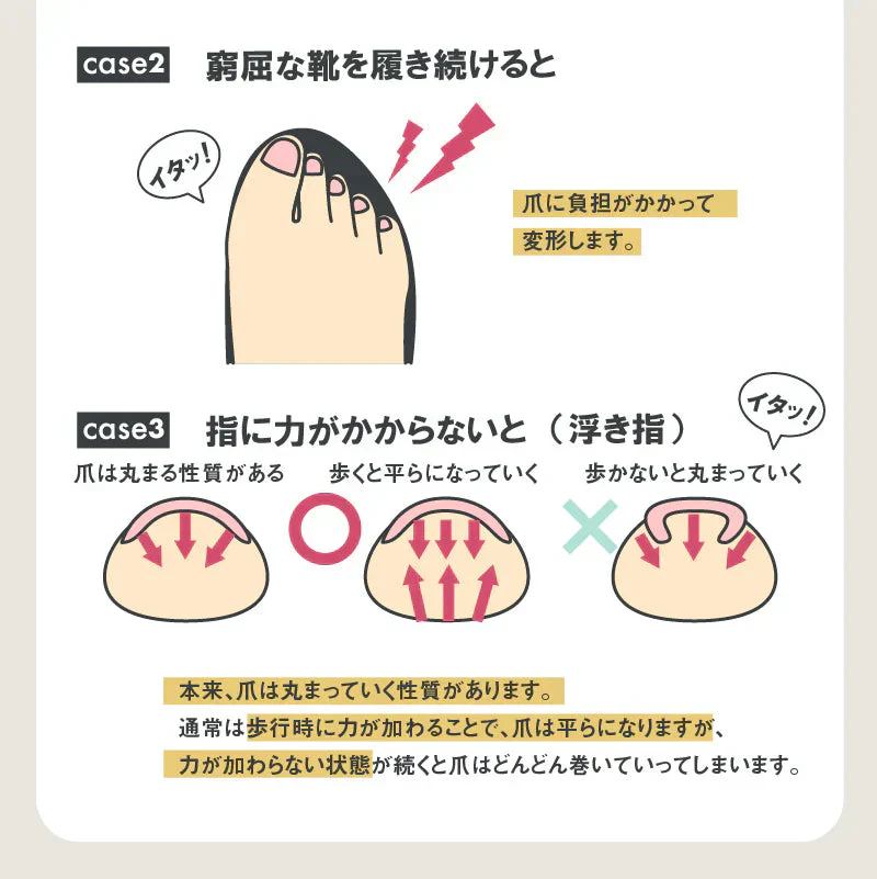 【やわらか巻き爪ガード】辛い巻き爪をしっかりサポート 巻き爪でお悩みの方におすすめ 歩くのが痛くてお出かけがツライ 爪切りが痛くてツライ  爪が痛くてお気に入りの靴が履けない巻き爪 クッション シリコン 保護テープ 深爪 浮き爪 外反母趾 矯正 親指 保護パット 痛み軽減 繰り返し使える 左右兼用 日本製  	 形状記憶特殊3Dシリコーンの反発力で巻き爪を引き上げ