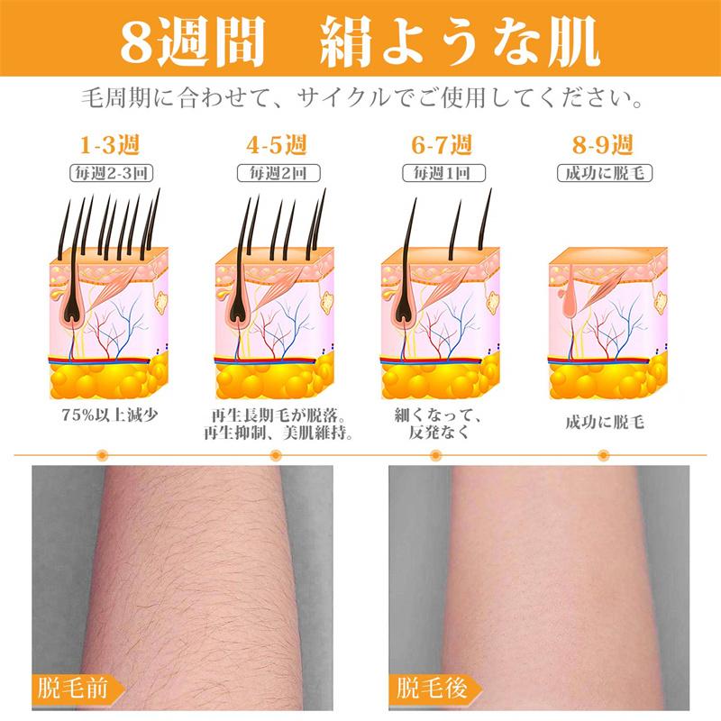 脱毛器 無痛脱毛 フラッシュ脱毛 自宅 男女兼用　ヒゲ脱毛 シェーバー レーザー プロレベル レディース メンズ IPL VIO対応 夏