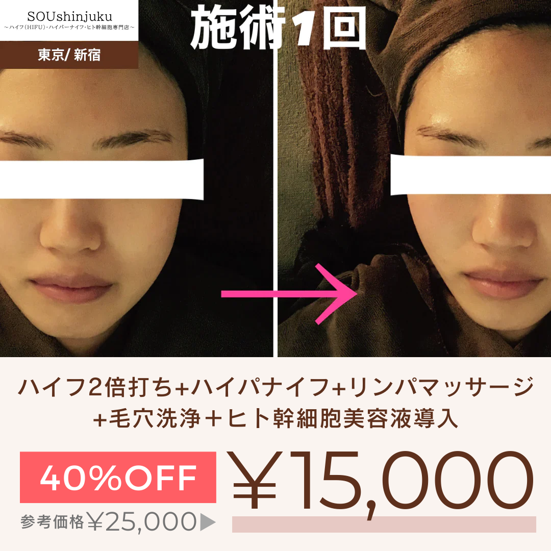 【再来限定】[超リフトUP×美肌] ハイフ2倍打ち+ハイパナイフ+リンパマッサージ+毛穴洗浄＋ヒト幹細胞美容液導入  【美容サロンチケット】美容/エステ/フェイシャルエステ/東京/新宿/メディカライクサロンSOU新宿