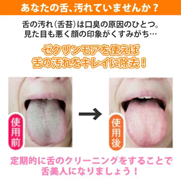 舌クリーナー ゼクリンMORE (4色アソート) 4本セット【メール便送料無料】 ／ タンクリーナー 口臭予防
