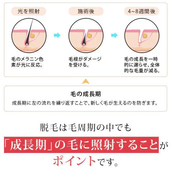 冷却光脱毛 イオンプルレエクラット