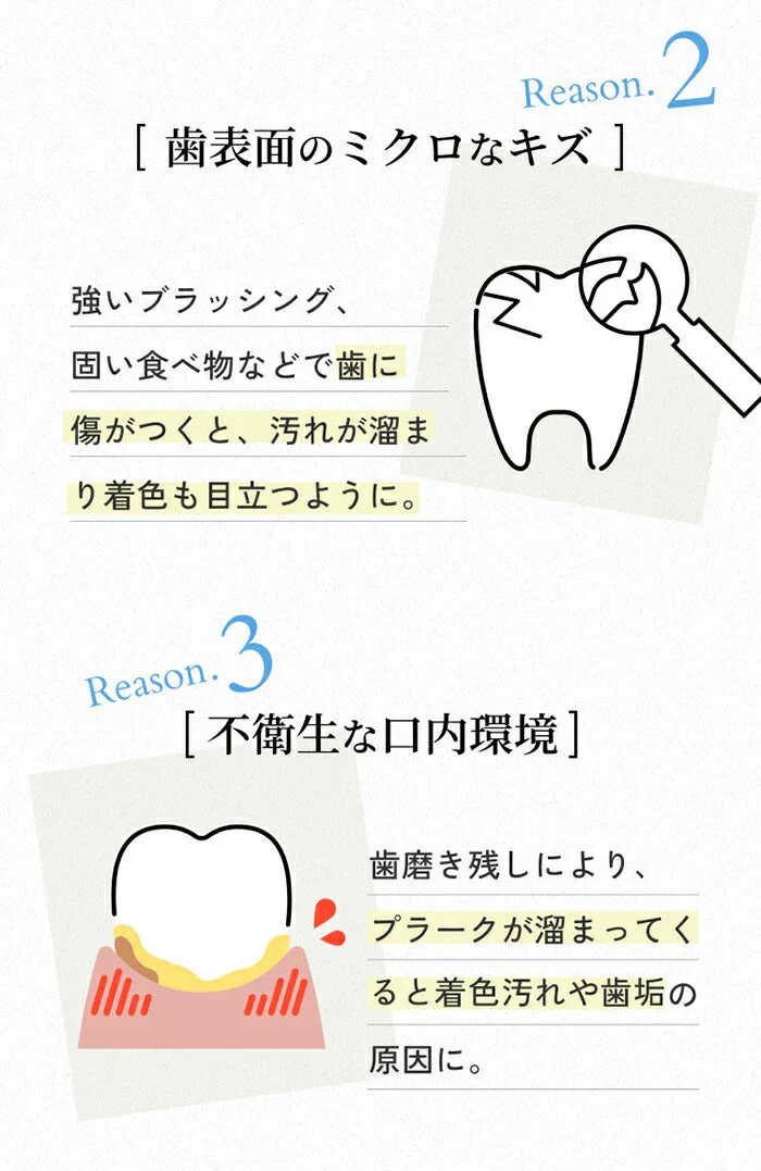 歯 ホワイトニング ペン 歯を白くする方法 マニキュア パールホワイト トゥースグロス
