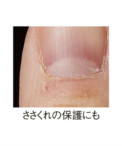 【指ぴたゲルガード】伸縮性抜群のゲルがお悩み部分をピタッとガード 水仕事OK 指関節 関節痛 指ガード 指サポーター ささくれ 美容師さんにおすすめ あかぎれ 皮膚保護 指の保護 指まわり4-6cm 指プロテクター 指サック 指サポーター 指関節 水仕事 指関節の痛み 目立ちにくい 水仕事 便利グッズ 美容師さんにおすすめ 繰り返し使用 自由にカット 自分サイズ 男女兼用