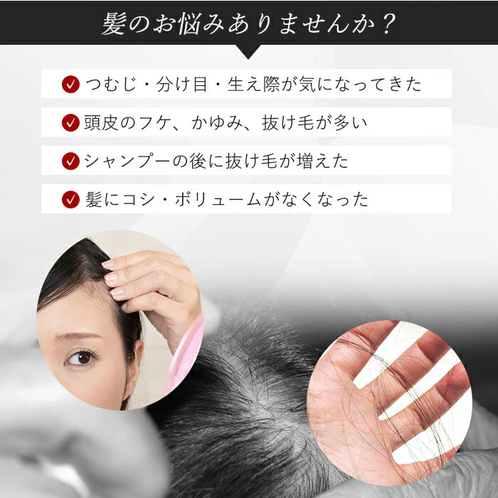 有効成分配合 育毛剤 育毛エッセンス 発毛剤 発毛促進 医薬部外品 フケ 薄毛 脱毛症 抜け毛対策 ヘアケア 増毛 ボリュームアップ 日本製 国産 / 薬用 育毛 びわの恵み 医薬部外品